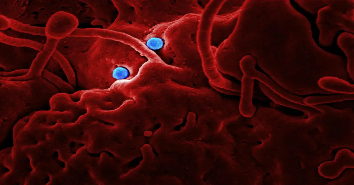Read more about the article What is Sickle Cell Disease? Understanding the Basics